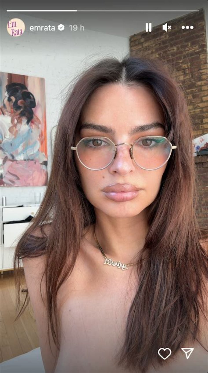 Emily Ratajkowski's Nude And Intimate Photos Leaked From iCloud